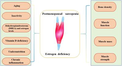 Research progress on the correlation between estrogen and estrogen receptor on postmenopausal sarcopenia